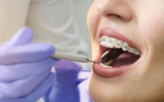 女生说长针眼是暧昧吗？科学与情感的碰撞